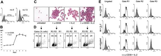 Figure 4. CD100 up-regulation is restricted to the proliferating cells. (A) Purified B-CLL cells from patients nos. 8 and 13 were cultured for 5 days in the presence of agonistic anti-CD38 mAb + IL-2 and evaluated by flow cytometry using a directly labeled anti-CD100 mAb. The gray profiles represent the expression levels of the receptor in untreated cells, while the open profiles indicate the fluorescence intensity in the anti-CD38 + IL-2 samples. The percentages in parentheses refer to the CD100+ population. (B) The kinetics of CD100 up-regulation: the y-axis represents the MFI values of CD100 expression obtained from 7 different samples. Error bars represent the SD. Purified B-CLL cells from patient no. 6 were exposed to agonistic anti-CD38 mAb, IL-2, or a combination of the 2 for 5 days; the morphology of the resulting population was evaluated by Giemsa staining (C) and by cytofluorographic analysis (D). Gate R1 contains the proliferating cells, while R2 identifies resting and R3 the apoptotic population (as described in “Results”). The results in panel E show that the cells within the R1 gate display increased CD100 expression, while the other 2 subsets are unmodified. The open profiles reflect CD100 expression in the anti-CD38 + IL-2 condition compared with anti-CD38 alone (top row, gray profile), IL-2 alone (middle row, gray profile), and the untreated condition (bottom row, gray profile). Representative data from 7 patients.