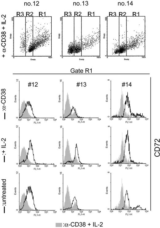 Figure 5. CD72 is down-modulated as a downstream event elicited upon CD38-mediated signals. Purified B-CLL cells from CD38+ patients were exposed to agonistic anti-CD38 mAb, IL-2, or a combination of the 2 for 5 days; the surface levels of CD72 were then evaluated by exploiting the same morphologic approach described in Figure 4 to distinguish the discrete cell populations. The results indicate that the synergistic presence of anti-CD38 mAb and IL-2 (gray profiles) selectively down-regulates CD72 in the cells of the R1 region. Open profiles refer to anti-CD38 (top row), IL-2 (middle row), and the untreated conditions (bottom row).