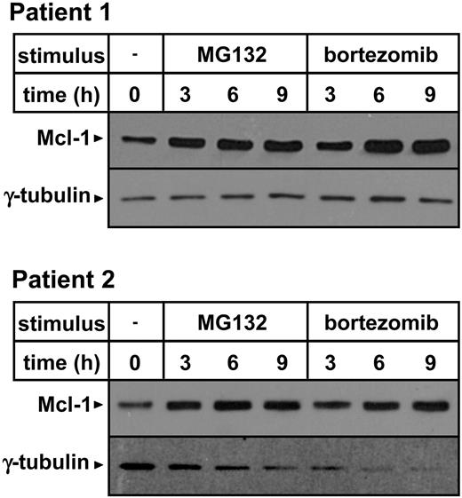 Figure 6. Proteasome inhibitors induce Mcl-1 accumulation in primary B-CLL cells. PBMCs were isolated from blood samples obtained from 2 patients with B-CLL. Leukemic cells, as detected by CD19 expression, represented 76.5% and 75% of the cell preparations obtained from patient 1 and patient 2, respectively. Cells (3 × 106/well) were incubated in 24-well plates in the presence or absence of 0.5 μM MG132 or 5 ng/mL bortezomib for the indicated amounts of time. Thereafter, cells were harvested and washed, and protein lysates were prepared. Mcl-1 and γ-tubulin expression were detected by Western blotting.