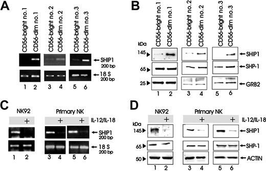 Figure 1. SHIP1 expression in NK cells. (A-B) CD56bright (lanes 1, 3, and 5) and CD56dim (lanes 2, 4, and 6) primary human NK cells were FACS purified from 3 separate donors. Cell pellets were collected and analyzed for SHIP1 transcript by RT-PCR with 18S rRNA used for nomalization (A) or directly lysed in Laemmli buffer and analyzed for protein by Western blot (B). (B) Western blot was performed using anti-SHIP1 (top panels), anti-SHP1 (middle panels), and anti-GRB2 (bottom panels) Abs sequentially on the same filter. (C-D) NK92 and enriched primary human NK cells were costimulated with monokines IL-12 (10 ng/mL) and IL-18 (100 ng/mL) for 24 hours (panel C, lanes 1-6; panel D, lanes 1-4) or 48 hours (panel D, lanes 5 and 6), after which cell pellets were collected and analyzed for SHIP1 transcript by RT-PCR (C) and for protein by Western blot (D). (D) Western blot was performed with anti-SHIP1 (top panels), anti-SHP1 (middle panels), and antiactin (bottom panels) Abs sequentially in the same filter.