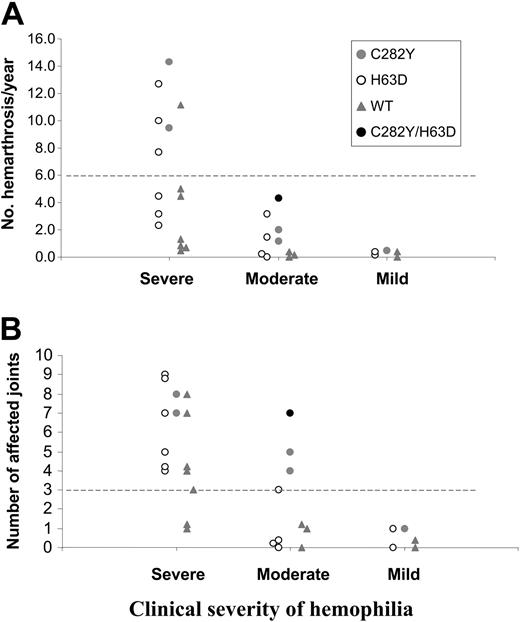 Figure 1. Severity of hemophilic arthropathy in relation to HFE mutations. Number of episodes of hemarthrosis/year (A) and number of affected joints (B) according to clinical severity of hemophilia. Individual patients in each group are represented according to the presence of HFE mutations: C282Y heterozygous (), H63D carriers (○), compound heterozygote (•), and wild-type (WT) patients (). Four patients were excluded: 2 with severe hemophilia (one doing prophylactic treatment at the time of the study and another with no clinical data available); 1 patient with moderate hemophilia without complete relevant clinical information; and 1 patient with mild disease doing immunotolerance treatment at the time of the study. The dotted lines represent the cutoff values established for hemarthrosis/year (> 6) as an indication of severity of the arthropathy. The cutoff for number of joints affected was arbitrarily established for this study (> 3).