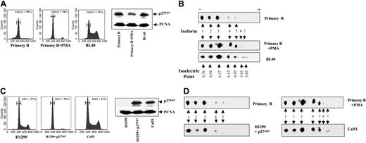 Figure 1. Increased posttranslational modification of p27kip1 correlates with cell-cycle entry. FACS analysis shows the percentage of cells arrested in G1/G0 (A, left panel) in primary B cells with or without treatment with PMA for 72 hours (labeled as primary B or primary B + PMA, respectively), Burkitt lymphoma cell line BL40 (labeled as BL40), (C) in H1299 cells with or without the inducible expression of p27kip1 (labeled as H1299, H1299 + p27kip1) and in Cal51 cells. Right-hand panels of A and C are Western blots showing the expression levels of p27kip1 in the corresponding cell populations used to carry out the FACS and 2D gel analysis. The isoforms 1 to 7 are indicated with arrows in panels B and D and their isoelectric points are 6.76, 6.59, 6.37, 6.12, 6.05, 5.93, and 5.83, respectively. Horizontal bars in panels A and C represent the marker used to calculate mean values of G0/G1 peak cell populations. PCNA indicates proliferating cell nuclear antigen.