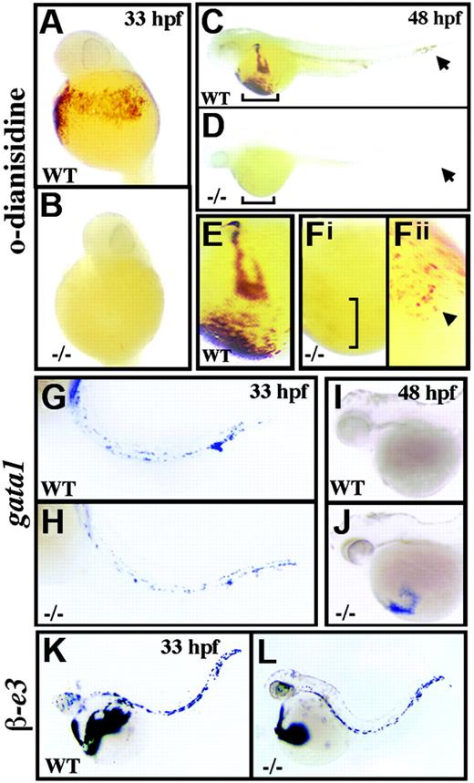 Figure 1. crs embryos are anemic despite normal blood specification. (A-F) Whole-mount o-dianisidine stain for hemoglobin in wild-type (WT) (A,C,E) and mutant (-/-) (B,D,F) embryos at 33 hpf (A-B) and 48 hpf (C-F). Arrows (C-D) indicate blood flow in the tail vessels. Blood flow over the yolk sac is bracketed (C-D) and shown higher magnification (E-Fi). A few o-dianisidine–positive cells over the yolk sac in mutant animals (bracket in Fi) are further magnified and indicated by an arrowhead (Fii). (G-L) Whole-mount in situ hybridization for gata1 (G-J) and βe3 globin (L) at 33 hpf (G,H,K,L) and 48 hpf (I-J) in wild-type (G,I-K) and mutant (H,J,L) embryos.