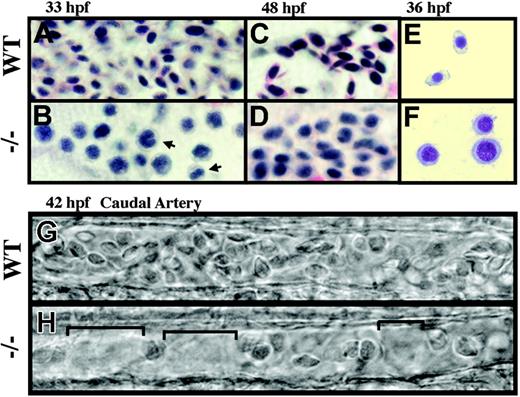 Figure 2. crs red blood cells fail to differentiate and are reduced in number. (A-D) Hematoxylin and eosin staining of blood cells from whole-mount wild-type (A,C) and mutant (B,D) embryos at 33 hpf (A-B) and 48 hpf (C-D). Binucleated cells were often observed (B, arrows). (E-F) Wright-Giemsa staining of isolated blood cells from wild-type (E) and mutant (F) embryos at 36 hpf. (G-H) Bright-field microscopy of blood cells in wild-type (G) and mutant (H) embryos at 42 hpf in the caudal artery with spaces between the reduced cell numbers in mutant animals bracketed (H).