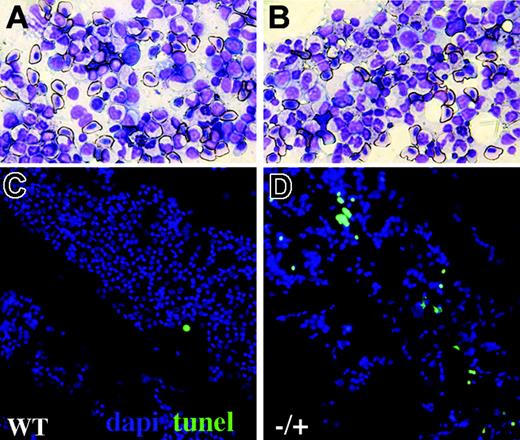 Figure 6. Increased blood apoptosis in adult crs heterozygotes. Kidney smears from wild-type (A,C) and heterozygous (B,D) adult crs animals showing hematopoietic progenitors and mature blood cells by Wright-Giemsa staining (A-B) or TUNEL (C-D) with nuclei shown by DAPI (4,6 diamidino-2-phenylindole; blue) and TUNEL (green) labeling dying cells.