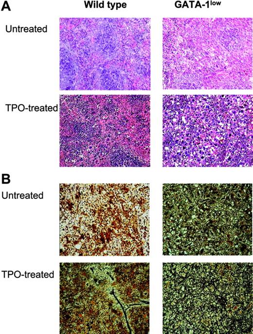 Figure 2. TPO treatment (100 μg/kg per day for 5 days) increased the frequency of Mks in hematopoietic tissues from both wild-type and GATA-1low littermates, but induced fibrosis only in those from wild-type animals. (A) Hematoxylin-eosin staining of spleen sections from untreated and TPO-treated (day 7) wild-type and GATA-1low littermates, as indicated. Massive hyperplasia of Mks is observed in the spleen from both wild-type and GATA-1low mice 7 days after TPO treatment. Sections from marrow and spleen of the same animals were processed in parallel and the results are not shown. Original magnification: × 20 in the top panels and × 40 in all the others; numerical aperture of the objectives, 0.55 and 0.70, respectively. (B) Gomori-silver staining of spleen sections from untreated and TPO-treated (day 7) wild-type and GATA-1low littermates (alternate sections with respect to those presented in the top panels). Note the presence of extensive fiber deposition in TPO-treated wild-type animals while there is no appreciable change in the fibers of the GATA-1low mice after TPO. Similar results were observed on sections from bone marrow and liver (not shown). Original magnification × 200; numerical aperture, 0.55.