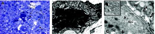 Figure 4. The Mks in the spleen from TPO-treated wild-type mice expressed several morphologic abnormalities characteristic of GATA-1low Mks. Semithin (A) and ultrathin (B-C) sections of the spleen from TPO-treated wild-type mice. The semithin section (A) shows a cluster of light- and heavy-electron dense Mks (Mk) surrounded by numerous neutrophils (arrowheads), fibroblasts (F plus arrows), and connectival fibers (CF). Upon ultrastructural examination (B), heavy-electron dense Mks present a morphology of cytoplasm and nucleus compatible with that of cells undergoing para-apoptosis.22 Furthermore, heavy-electron dense Mks contain neutrophils (Neu) embedded in their cytoplasm (insert in C), as proved by immunogold staining for myeloperoxidase (C) that shows gold particles (arrowheads) in the cytoplasm both of the neutrophil and of the Mks. Similar results were observed in the spleen of at least 3 separate TPO-treated wild-type mice. Magnification: × 100 (A), × 3000 (B, insert in C), and × 30 000 (C). Numerical aperture of the objective lenses: 0.1.