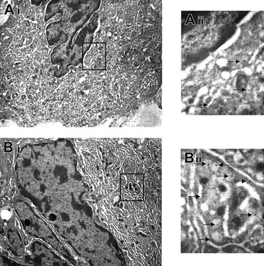 Figure 5. TPO treatment restored Mk maturation in GATA-1low mice. Immunoelectron microscopy for von Willebrand factor of Mks from the spleen of untreated GATA-1low mouse (A) and from a mutant mouse after 7 days of TPO treatment (B). The cytoplasm of the Mks from TPO-treated animals contains clearly recognizable platelet territories with numerous electron-dense granules, which, when analyzed at higher magnification, contain several von Willebrand factor–related gold particles (Bii). The rectangle in panels A and B indicates the region of the Mks shown at higher magnification in Aii and Bii, respectively. The arrows in Aii and Bii indicate von Willebrand factor–related gold particles. Magnification, × 4400 (Ai,Bi) and × 30 000 (Aii,Bii). Numerical aperture of the objective lenses: 0.1.