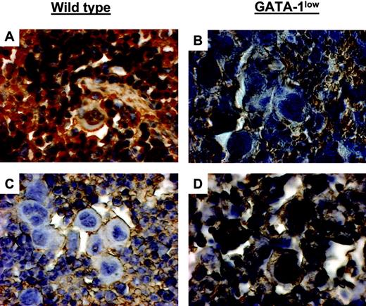 Figure 7. TPO treatment increased GATA-1 content in Mks from GATA-1low mice while decreasing GATA-1 content in Mks from wild-type littermates. GATA-1 immunostaining of spleen sections from untreated (A-B) and TPO-treated (day 7 after 100μg TPO/kg per day for 5 days) (C-D) wild-type and GATA-1low mice, as indicated. Mks in spleen sections from untreated wild-type and TPO-treated GATA-1low mice strongly reacted with the GATA-1 antibody, while those from untreated GATA-1low and TPO-treated wild-type animals did not. Similar results were observed in sections from marrow and liver from these same animals (not shown). Original magnification × 400. Numerical aperture of the objective lenses: 1.30.