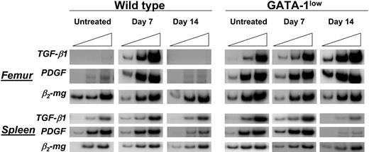 Figure 8. TPO treatment increased expression of TGFB1 mRNA in cells from femur and spleen of wild-type mice but not in those from their GATA-1low littermates. Semiquantitative RT-PCR analysis for the expression of TGFB1, PDGF, and β2-microglobulin (β2-mg, as control), in femur and spleen from untreated or TPO-treated (7 and 14 days after being treated with 100 μg TPO/kg per day for 5 days) wild-type and GATA-1low littermates. Each product was amplified for increasing number of cycles,25,30,35 as indicated by the triangle on the top of the panels. Similar results were obtained in 2 additional experiments.