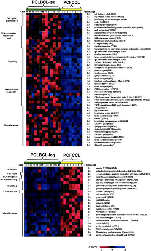 Figure 2. Differentiating genes in primary cutaneous large B-cell lymphoma. Seventy-one statistically significant differentially expressed genes identified as most discriminating genes between primary cutaneous follicle center cell lymphoma (PCFCCL) and primary cutaneous large B-cell lymphoma of the leg (PCLBCL-leg) with fold changes of at least 3.0 were classified by biologic function. Forty-eight genes were highly expressed in the group of PCLBCL-leg, and 23 genes were up-regulated in the group of PCFCCL. Genes indicated by an asterisk (*) were not present in the B-cell signature.22