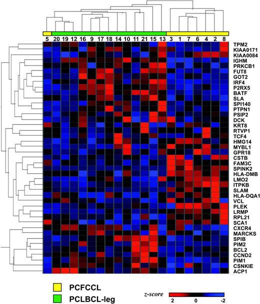 Figure 5. Expression of activated B-cell profile and germinal center profile genes in primary cutaneous large B-cell lymphoma. Hierarchical clustering analysis of primary cutaneous follicle center cell lymphoma (PCFCCL) and primary cutaneous large B-cell lymphoma of the leg (PCLBCL-leg) was performed based on the expression of 43 genes present in a recently described list consisting of 43 genes that discriminate between activated B-cell (ABC) and germinal center B-cell (GCB) types of diffuse large B-cell lymphoma with highest significance.27 These 43 genes were identified previously using the Affymetrix HU6500 microarray after the assignation of 274 DLBCL to ABC type or GCB type using a predictor model based on 14 genes represented on the Affymetrix HU6500 microarray of 27 predictor genes of the lymphochip. Hierarchical clustering based on these 43 selected genes clustered, respectively, 7 of 8 PCFCCL and 13 of 13 PCLBCL-leg in 2 distinct groups.
