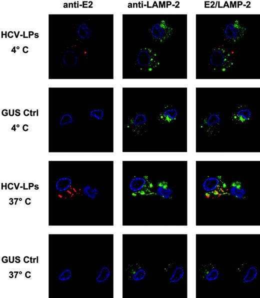 Figure 6. Temperature-dependent HCV-LP entry into imDCs. Monocyte-derived imDCs were incubated with HCV-LPs or insect cell control preparation (GUS Ctrl) for 1 hour at 4°C (for HCV-LP binding) or 37°C (for HCV-LP entry). Then, DCs were washed in ice-cold PBS, fixed, and permeabilized. HCV-LPs were detected with chimpanzee anti-E2 mAb (49F3) and Cy3-conjugated anti–human IgG antibody (red fluorescence). For costaining of cytosolic lysosomal protein, cells were incubated with a mouse anti–LAMP-2 mAb and FITC-conjugated anti–mouse IgG antibody (green fluorescence). Nuclear staining was performed using DAPI (4′,6-diamidino-2-phenylindole; blue fluorescence). Comparative analysis of stained imDCs by confocal laser scanning microscopy revealed temperature-dependent HCV-LP internalization.