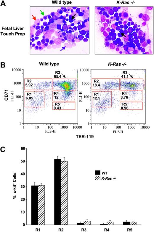 Figure 1. Effect of K-Ras deficiency on fetal liver erythropoiesis. (A) Representative fetal liver touch preps from WT and K-Ras-/- day-13.5 embryos. Touch preparations were stained with Wright Giemsa. Numerous erythropoietic cells in all stages of differentiation are observed in WT fetal livers and are represented as follows: proerythroblasts by a blue arrow; basophilic erythroblasts by a black arrow; polychromatophilic erythroblasts by a green arrow; orthochromatophilic erythroblasts by a red arrow; and mature enucleated erythrocytes by a purple arrow. In contrast, a marked increase in proerythroblasts (blue arrow) and basophilic erythroblasts (black arrow) was observed in K-Ras-/- fetal livers with a concomitant decrease in more mature polychromatophilic and orthochromatophilic erythroblasts and a paucity of enucleated erythrocytes. Slides were visualized under an Olympus BX51 microscope (Olympus, Melville, NY) equipped with a UPlan FI 40 ×/0.75 objective lens. Photomicrographs were acquired with an Olympus DP11 camera using MicroSuite imaging software (Olympus). Five other experiments showed similar results. (B) Representative flow cytometric analysis of erythroid differentiation in vivo. Freshly isolated day-13.5 WT or K-Ras-/- fetal livers were doubly stained with anti-CD71–FITC and anti–Ter-119–PE. Regions R1 to R5 define distinct populations of erythroid progenitor cells at different stages of differentiation as described previously.18 Primitive progenitor cells (including mature BFU-Es and CFU-Es) are shown in R1, proerythroblasts and early basophilic erythroblasts in R2, early and late basophilic erythroblasts in R3, chromatophilic and orthochromatophilic erythroblasts in R4, and late orthochromatophilic and reticulocytes in R5, as previously described.18 Numbers represent the percentage of cells within that region. Day-13.5 wild-type fetal livers display normal distribution of erythroid cells at different stages of differentiation. K-Ras-/- fetal livers demonstrate a delay in differentiation at the basophilic erythroblast level: R2 to R3. Five other experiments showed similar results. (C) Percentage of freshly isolated K-Ras-/- or WT day-13.5 fetal liver cells expressing c-kit in regions R1 to R5, which define distinct populations of erythroid progenitor cells at different stages of differentiation. Freshly isolated day-13.5 WT or K-Ras-/- fetal livers were stained with anti-CD71–FITC, anti–Ter-119–PE, and anti–c-kit–APC antibodies as described in “Apoptosis, proliferation, and differentiation assays.” The majority of c-kit+ cells were identified in the more immature erythroid progenitor populations in R1 and R2 and no significant difference in the percentage of c-kit+ cells was observed in the different gated populations (R1-R5) between the 2 genotypes. Results represent the mean percentage of c-kit+ cells and error bars represent the standard error of the mean of 5 parallel independent experiments from embryos isolated from the same litter.