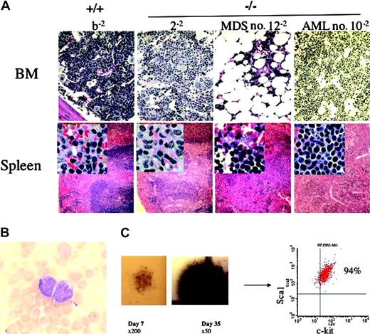 Figure 3. Histologic and hematologic abnormalities in secondary recipients of cultured Fancc-/-cells. (A) Cellular and histologic evaluation of the hematopoietic organs. The test cell genotype and individual animal numbers are indicated. The top panel shows the bone marrow (BM) histology (original magnification × 200) subsequent to staining with hematoxylin and eosin. Specimens reconstituted with WT cells (b-2) or freshly isolated Fancc-/- cells (2-2) have normal histology, whereas the bone marrow from 2 recipients of Fancc-/- cells that had been cultured ex vivo prior to transplantation had significant hypoplasia (no. 12-2) or had a hyperplastic marrow with a homogeneous population of immature blasts (no. 10-2). The bottom panel shows the splenic histology (original magnification × 100) with insets of the red pulp of spleen (original magnification × 400). The b-2 and 2-2 recipients have normal splenic architecture, whereas there is a disruption of the normal red and white pulp with myeloid cell invasion in no. 12-2 and no. 10-2, respectively. (B) Representative blast cells from the peripheral blood of mouse no. 10-2 (original magnification × 1000). (C) The clonogenic growth of a representative small, dysplastic myeloid colony from mouse no. 10-2 on day 7 of culture is shown in the photomicrograph on the left (original magnification × 200). A photograph of the same colony is shown on day 35 of culture (middle; original magnification × 50). (Right) Cells isolated from that colony revealed a homogeneous population of immature phenotypic cells shown using fluorescence cytometry.