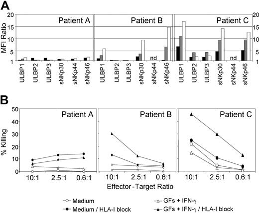 Figure 6. Up-regulation of ULBP and NCR ligands increases the susceptibility of AML blasts to NK cell–mediated cytotoxicity. (A) Up-regulation of ULBP and NCR ligands on AML blasts from 3 patients, as determined by FACS analysis of blasts cultured for 4 days in medium only (▪), with GFs (FL + SCF + GM-CSF; ▦) or GFs + IFN-γ (□). (B) Killing of blasts cultured for 4 days without (medium; circles) or with GFs + IFN-γ (triangles) was determined without (open symbols) or with (closed symbols) blocking of HLA class 1 molecules with mAb (10 μg/mL), as indicated. NK cells derived from healthy donors were used at the indicated effector-target ratios. The HLA status of donor and target cells revealed the KIR ligand incompatibility in patient A and at least 1 matching HLA allele in patients B and C (Cw1/Cw3 and Cw3/Cw7, respectively).