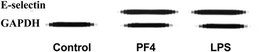 Figure 1. PF4 increases E-selectin RNA in HUVECs. RPA of E-selectin RNA in HUVECs exposed to media alone (control), PF4 (20 μg/mL), or LPS (100 ng/mL). GAPDH was also measured as an internal control. Data are representative of 3 experiments performed.