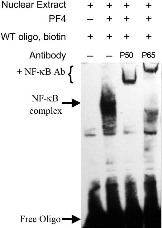 Figure 7. Specificity of NF-κB binding. EMSAs were performed using nuclear protein from HUVECs as described in Figure 5. Prior to electrophoresis, complexes were incubated with antibodies to either the P50 or P65 subunit of NF-κB. Binding of these antibodies results in a super shift (denoted by +NF-κB Ab) due to the increased mass of the antibody. Data are representative of at least 3 independent experiments.