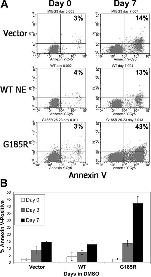 Figure 3. G185R NE mutant induces accelerated apoptosis of differentiating HL-60 cells. (A) Annexin V staining and flow cytometric analysis showing increased numbers of Annexin V-positive cells in G185R-transduced cells at day 7 of DMSO treatment. Percentages indicate fraction of Annexin V-positive cells. (B) Bar graph depicting the percentage of Annexin V-positive cells in transduced cells cultured in DMSO-containing media for day 0 (□), day 3 (▦), and day 7 (▪). Results shown are representative of 3 different experiments, with standard deviations.