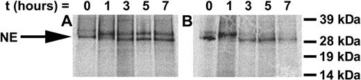 Figure 4. Synthesis and intracellular processing of WT NE and the G185R mutant. Pulse-chase analysis of metabolically labeled cells transduced with (A) WT NE or (B) G185R mutant NE form. NE appears as a doublet of Mr approximately 32 and 29 kDa. Arrow indicates the migration of proenzyme rapidly processed in G185R-transduced cells.