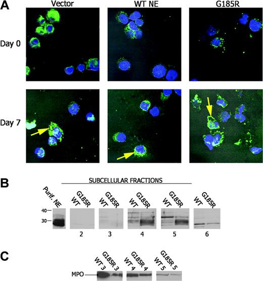 Figure 5. Aberrant subcellular localization of NE in G185R cells. (A) Confocal immunofluorescence microscopy shows the subcellular distribution of NE (green) with counterstaining of nuclei (Hoechst, blue). (B) Immunoblot analysis of subcellular fractions from WT NE- and G185R NE-transduced cells blotted with an antibody to NE. NE is seen as a broad low molecular-weight species localizing to fractions 4 to 6 in G185R cells. (C) The blot in panel B was stripped and reblotted with antibody to MPO showing an identical distribution pattern for MPO in WT- and G185R-transduced cells.