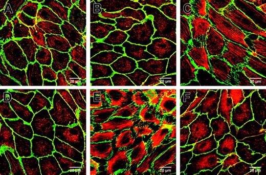 Figure 7. PDE2 inhibition reduced TNF-α and thrombin-induced F-actin and VE-cadherin redistribution. HUVECs were grown to confluency on gelatin-coated Thermanox slides, stained for F-actin and VE-cadherin, and visualized by double immunofluorescence (630-fold magnification). Cells treated with vehicle (A) or PDP 1 μM (B) did not show stress fibers or intercellular gap formation as visualized with F-actin–specific phalloidin Alexa 546 (red) and VE-cadherin (green). TNF-α (10 ng/mL, 2 hours) (C) or thrombin stimulation (0.75 U/mL, 15 minutes) (E) caused a massive increase of stress fibers, redistribution of VE-cadherin, and gap formation. Pretreatment with 1 μM PDP for 30 minutes before TNF-α (D) or thrombin (F) stimulation prevented VE-cadherin redistribution and gap formation, reduced stress fibers, and maintained the peripheral dense band. Representative fields of HUVEC monolayers of 3 experiments are shown. Bars = 20 μm.