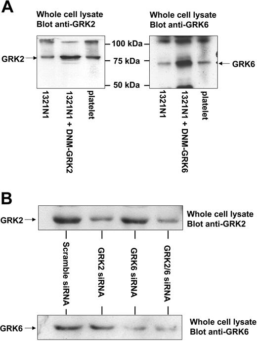 Figure 5. GRK2 and GRK6 expression in 1321N1 cells and platelets. (A) 1321N1 cells were transfected with 5 μg DNA containing empty vector or DNM-GRK constructs. Whole cell lysates from these cells or human platelets were subjected to SDS-PAGE, followed by immunoblotting with GRK-specific primary, as detailed in “Materials and methods.” Data shown are representative of 3 experiments. (B) Effect of siRNA treatment on endogenous GRK expression in 1321N1 cells. 1321N1 cells stably expressing P2Y12 purinergic receptors were transfected with scrambled, GRK2-, or GRK6-specific siRNAs twice in a 24-hour interval, and the cells were harvested after 4 days. GRK2 expression was analyzed by immunoblotting using an anti-GRK2 monoclonal antibody, whereas GRK6 expression was analyzed using an anti-GRK6 polyclonal antibody. These results are representative of at least 3 similar experiments. Similar results were obtained in 1321N1 cells stably expressing P2Y1 purinergic receptors (data not shown).