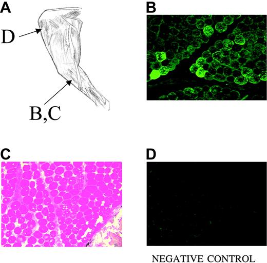 Figure 1. Histology of normal dog muscle 8 weeks after direct intramuscular injection of AAV-CMV-canine F.IX. (A) Anatomy of dog hindlimb, showing sites of biopsy. (B) Immunofluorescence staining for canine F.IX at injection site. (C) Hematoxylin and eosin staining of same site, showing normal histology. Vacuoles within muscle fibers are due to freeze artifact. (D) Immunofluorescence staining of uninjected muscle in same limb. For all panels, original magnification ×100.
