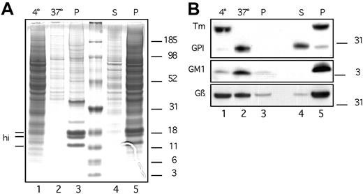 Figure 3. Solubilization of ART2.2-GPI but not ART2.2-Tm by TX-100 is temperature sensitive. DC27.10 cells stably transfected with ART2.2-GPI or ART2.2-Tm were pooled (1 × 106 of each cell type) and lysed in 1% TX-100 for 10 minutes at 4°C (lane 1). Insoluble material was pelleted by centrifugation and solubilized again in 1% TX-100 for 20 minutes at 37°C (lane 2). Insoluble material was pelleted by centrifugation. Pellets were solubilized by ultrasonication in 2% SDS (lane 3). A separate aliquot of pooled ART2.2-GPI– and ART2.2-Tm–transfected DC27.10 cells (1 × 106 of each) was incubated for 60 minutes with PI-PLC. PI-PLC–treated cells were pelleted by centrifugation, and the supernatant was collected (lane 4). The cell pellet was solubilized directly by ultrasonication in SDS (lane 5). Proteins were size fractionated by SDS-PAGE and stained with Coomassie brilliant blue (A). Histone bands in lane 3 are indicated (hi). An identical gel was subjected to immunoblot analysis (B). Immunodetection was performed sequentially by incubation of the blot with peroxidase (PO)–conjugated cholera toxin (GM1), PO-conjugated anti-FLAG mAb M2 (ART2-Tm and ART2-GPI), and rabbit antiserum T20 followed by PO-conjugated anti–rabbit IgG (Gβ). Results are representative of 3 independent experiments.