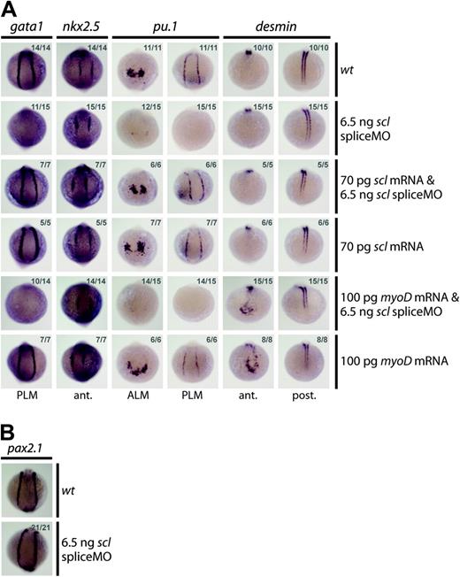 Figure 3. SpliceMO-mediated Scl knockdown is highly specific. (A, B) Wholemount 10-somite (14 hpf) embryos (10.5 × magnification); posterior/anterior views as indicated; dorsal, top; numbers of embryos represented in gray. (A) Coinjection with correctly spliced scl mRNA but not myoD mRNA, together with the scl spliceMO, rescued early gata1 and pu.1 expression in the PLM and the PLM and ALM, respectively. Nkx2.5 in the heart (A) and Pax2.1 in the pronephric duct mesoderm (B) were unaffected by these injections. Ectopic anterior expression of des at 10 somites (14 hpf) confirms that myoD mRNA was active.
