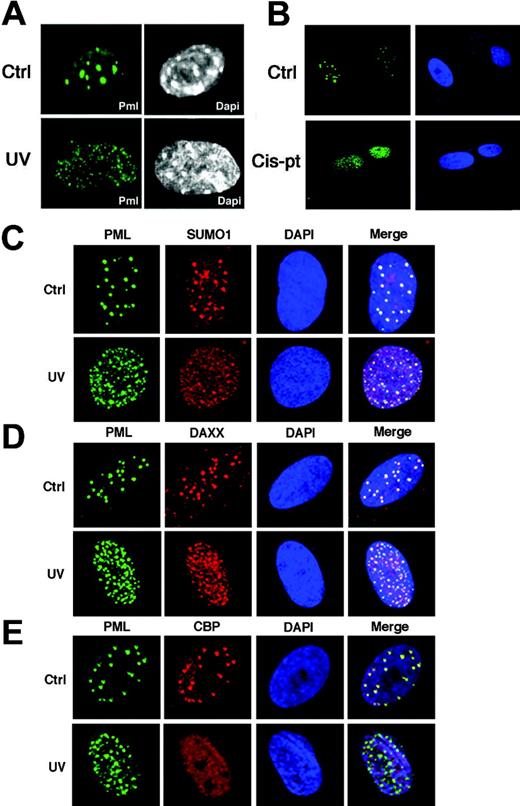 Figure 4. PML relocalizes into novel microspeckles upon UV radiation. (A) MEFs were UV-irradiated (60 J/m2) and then stained with an antibody against mouse PML. Nuclei were visualized by DAPI (4′,6-diamidino-2-phenylindole). (B) PML is delocalized upon cisplatin treatment. WI-38 cells were treated with cis-pt at 10 μg/mL for 6 hours and subsequently fixed and stained with an antibody against human PML (green). Nuclei were visualized by DAPI. (C-E) Analysis of PML-NB components in UV-irradiated fibroblasts. (C) WI-38 cells grown on coverslip were UV-irradiated (60 J/m2), stained with antibodies anti-PML (green) and anti-SUMO1 (red), and analyzed by confocal fluorescence microscopy. Nuclei were visualized by DAPI (blue). Colocalization of PML and SUMO1 is shown (yellow). (D) WI-38 cells were stained with antibodies against PML (green) and DAXX (red). Colocalization of PML and DAXX is shown (yellow). (E) Cells were stained with antibodies against PML (green) and CBP (red). Colocalization of PML and CBP is shown (yellow).