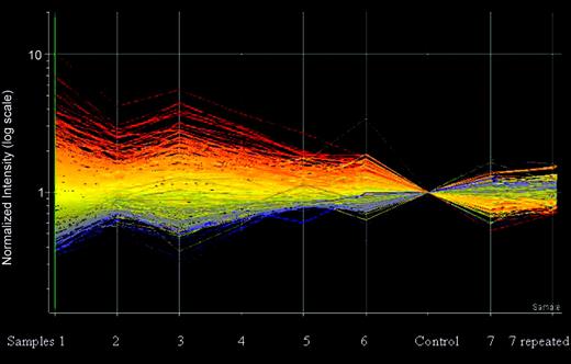 Figure 2. Protein expression in the 6 MCL samples compared with normal control. The y-axis is a log scale of the normalized intensity. The data points are colored by expression with lower signal values colored blue and higher values, red and presented by their relative level in each sample compared with the normal control. The central line is the midpoint with the lines above and below at log-rank increase or decrease in expression. MCL7, which had a reversed expression, is presented on the right side of the control and is repeated twice. Note the reversed expression of the proteins in MCL7 as marked by the color changes. Data were analyzed with Genespring software.