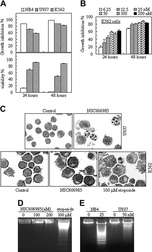 Figure 2. Three leukemic cell lines show different sensitivity to NSC606985-induced apoptosis. (A) NB4, U937, and K562 cells were treated with 50 nM NSC606985 for 24 and 48 hours. Growth-inhibiting rate (top) and cell viability (bottom) were determined. The values are the mean + SD of a triplicate experiment. (B) K562 cells were incubated with the indicated concentrations of NSC606985 for 24 and 48 hours, and the growth inhibition rates were determined. The values are the mean + SD of a triplicate experiment. (C) U937 (top row) and K562 cells (bottom row) were treated with or without 50 nM and 100 nM NSC606985, respectively, for 48 hours. Cytomorphology was examined with Wright staining. Images were viewed using an Olympus BX60 microscope equipped with a 100 ×/1.3 objective lens, and were acquired through a SPOT RT camera and SPOT software. For K562 cells, the treatment with etoposide at 100 μM for 24 hours was used as positive control. (D) K562 cells were incubated with the indicated concentrations (nM) of NSC606985 or with 100 μM etoposide for 48 hours. DNA samples from these treated cells were electrophoresed in a 2% agarose gel. (E) NB4 and U937 cells were treated with NSC606985 at the indicated concentrations for 48 hours, and DNA samples from the cells were electrophoresed in a 2% agarose gel. All experiments were repeated 4 times with similar results.