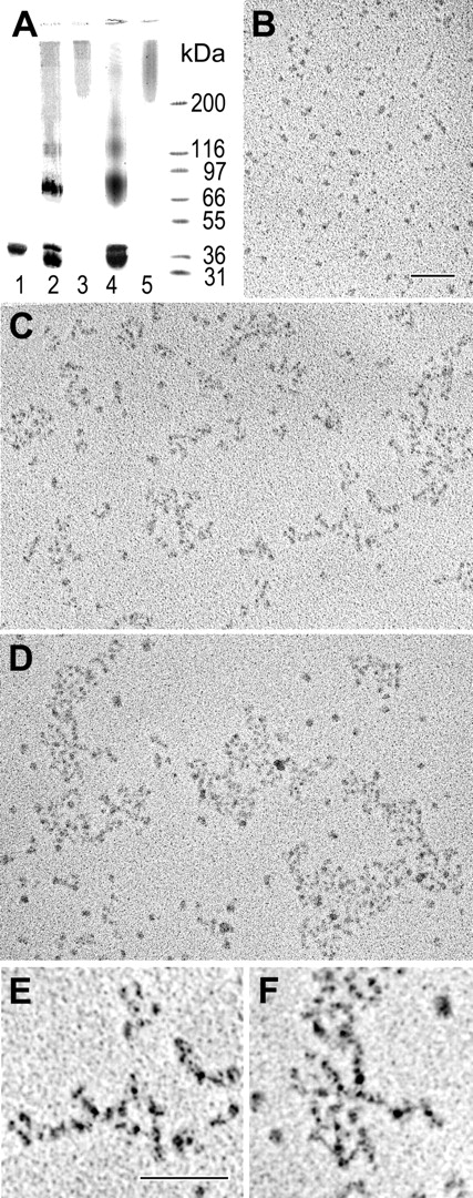 Figure 1. Preparation and characterization of αC(FXIII) and αC(tTG) oligomers. (A) SDS-PAGE analysis of the recombinant αC domain fragment and its oligomers. The αC domain (lane 1) was covalently cross-linked with factor XIIIa (lane 2) or tTG (lane 4), and the resulting material was subjected to size-exclusion chromatography to separate high molecular mass fractions containing αC(FXIII) oligomers (lane 3) or αC(tTG) oligomers (lane 5); the right outer lane contains protein markers of the indicated molecular mass. (B-D) Electron microscopy of the rotary shadowed samples of the αC domain fragment (B) and its αC(FXIII) and αC(tTG) oligomers (C-D, respectively). Bar indicates 100 nm. (E-F) Higher magnification and contrast images of small portions of panels C and D, respectively, showing details of the branching polymers. Bar indicates 100 nm.
