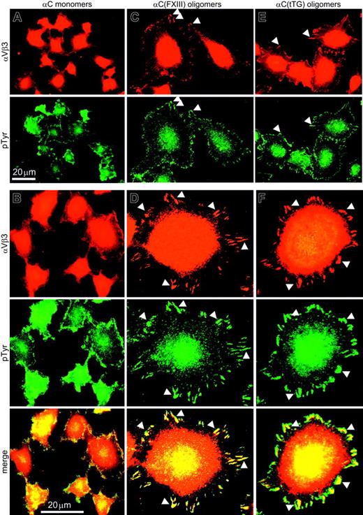 Figure 5. Endothelial cells assemble prominent focal adhesions on αC(FXIII) and αC(tTG) oligomers but not on αC monomers. HUVECs in serum-free DMEM were plated on 20 μg/mL αC monomers (A-B), αC(FXIII) oligomers (C-D), or αC(tTG) oligomers (E-F) for 2 hours. Paraformaldehyde-fixed, Triton X-100–permeabilized cells were double stained with anti-β3 integrin mAb 25E11 and polyclonal antiphosphotyrosine antibodies, followed by rhodamine-labeled anti–mouse and fluorescein-conjugated anti–rabbit IgG. A clear peripheral staining for αVβ3 integrin and phosphotyrosine was observed at lower magnification in HUVECs on αC oligomers (C,E) but not on monomeric αC domains (A). At higher magnification, well-developed focal contacts containing αVβ3 integrin and phosphotyrosine were detected in HUVECs on αC oligomers (D,F), whereas no distinct focal adhesions were formed on αC monomers (B). Bars indicate 20 μm. Arrowheads mark colocalization of αVβ3 integrin and phosphotyrosine in the peripheral focal contacts of HUVECs on αC oligomers.
