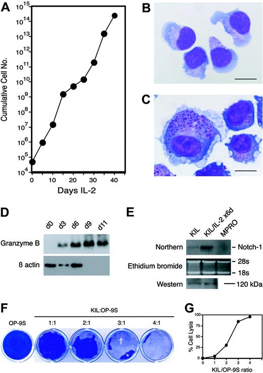 Figure 6. IL-2 induces further proliferation and differentiation of KIL. (A) Growth curve of KIL stimulated with human IL-2 (20 ng/mL) alone. The vertical axis is plotted on a logarithmic scale. Each point represents the mean of triplicates. (B) Wright-Giemsa–stained KIL. Note the fine azurophilic granules in the cytoplasm. Bar = 20 μm. (C) Wright-Giemsa–stained KIL stimulated with IL-2 (20 ng/mL) alone for 6 days. Note the larger cell size, ruffled cell membrane, and prominent azurophilic granules. Bar = 20 μm. (D) Western analysis of the expression of granzyme B by KIL stimulated with IL-2 alone for 0, 3, 6, 9, and 11 days. The 32-kDa granzyme B is indicated. Low-level granzyme B expression was detectable in the day 0 sample on the original film. The same blot was reprobed with an anti–β-actin antibody. (E) Northern and Western analyses of Notch-1 expression in KIL stimulated with IL-2 alone for 0 and 6 days and in the promyelocyte cell line, MPRO (negative control).31 The Northern blot (top) was hybridized to a cDNA probe encoding the intracellular domain of mNotch1. The ethidium bromide–stained gel is shown in the middle row. The bottom row is a Western blot probed with affinity-purified antibodies against the carboxy terminus of mNotch1. The 120-kDa fragment of mNotch1 is indicated. (F) Cytolytic activity of KIL. KIL cells were incubated with monolayers of OP-9S at 1:1 to 4:1 effector-to-target ratios in a 12-well plate in growth medium containing IL-7 and SCF. KIL lysed the OP-9S monolayers in 24 to 48 hours. The OP-9S monolayers were then fixed and stained with Coomassie blue. Lysed or denuded areas (†) of the OP-9S monolayers appear clear whereas the intact areas (*) appear blue. (G) The relationship between the degree of cell lysis and the effector-to-target ratio.
