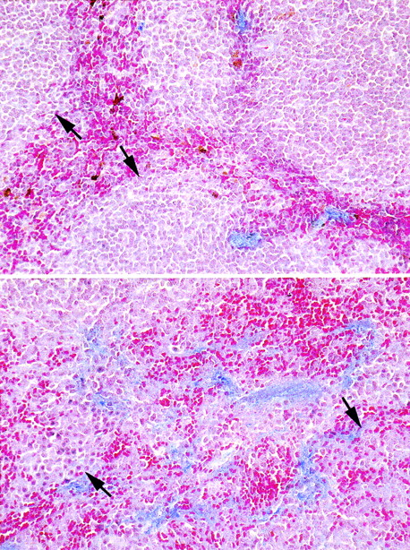 Figure 4. Altered spleen architecture in Mpl-/- c-MybPlt4/Plt4 mice. Histologic section of spleens from Mpl-/- c-MybPlt3/Plt3 (lower panel) and control Mpl-/- c-Myb+/+ mice (upper panel) showing the increased network of collagen fibers in the red pulp (blue) and lymphoid follicles (arrows), which were were small and usually lacked germinal centers in mutant mice. Sections were photographed to Kodachrome ASA64 film (Eastman Kodak, Rochester, NY) using a Zeiss Axiophot microscope (Zeiss, Thornwood, NY) and camera with a Zeiss 20× objective lens, 0.60 numerical aperture. The scanned images were processed using Adobe Photoshop software (Adobe, San Jose, CA).