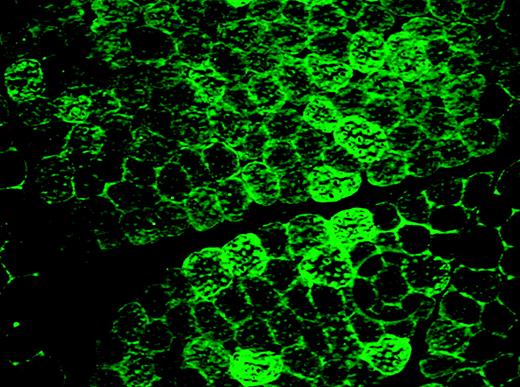 Histology of normal dog muscle 8 weeks after intravascular vector delivery by isolated limb perfusion. Immunofluorescence staining for canine F.IX, showing extensive positive staining. See the related figure in the article beginning on page 3458.