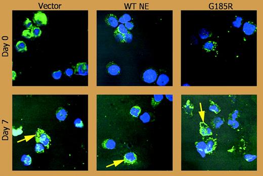 Confocal immunofluorescence microscopy shows the subcellular distribution of NE (green) with counterstaining of nuclei (Hoechst, blue). See the complete figure in the article beginning on page 3397.