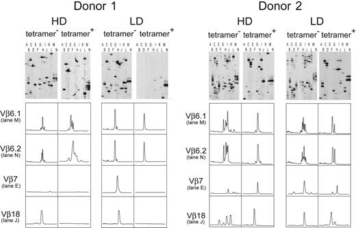 Figure 5. TCR repertoires of tetramer-sorted HD- and LD-aAPC–induced HA-1–specific CTLs. CDR3-size spectratyping was applied to analyze the TCR repertoire of HD-aAPC– and LD-aAPC––induced CTLs from D1 (left) and D2 (right). The upper panels show the respective spectratyping gels with the 24 Vβ families distributed on 14 lanes. The amplicons displayed on each lane are detailed in “Materials and methods.” Lower panels show histograms of selected Vβ families as representative examples of skewed TCR repertoires of HD- and LD-aAPC–induced CTLs. Although usage of Vβ families varied between HD- and LD-aAPC–induced CTLs in both donors, Vβ6 using CDR3s was detected consistently in HD- as well as in LD-aAPC–induced CTLs from both donors.