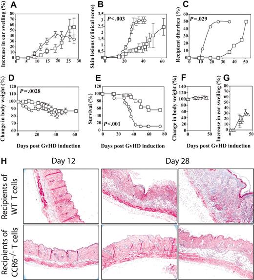 Figure 2. Transfer of naive CD4+ T cells from CCR6-deficient mice to MHC-matched/mhc-mismatched recipients delays GvHD onset and reduces severity of symptoms. The time course of symptom development is shown for (A) ear inflammation; (B) erythrosquamous skin lesions; (C) percentage of mice showing diarrhea; (D) changes in body weight; and (E) survival curves. Mean values ± SD are shown from 1 experiment representative of 3 independent transfer experiments in which recipient mice were reconstituted with 0.35 × 106 MHC-matched/mhc-mismatched WT CD4+CD45RBhigh naive T cells (○, n = 37) or CCR6-deficient CD4+CD45RBhigh naive T cells (□,n = 57). Results are also shown of body weight change (F) and ear inflammation (G) from control experiments in which naive (▵) BALB/c CD4+ T cells were transferred to CB17-SCID recipient mice. Statistical analyses were performed as in Figure 1, obtaining the P values shown in the panels. (A) P < .001 (day 19 ACT). (H) Representative hematoxylin/eosin–stained dorsal skin sections of T-cell recipients from WT or CCR6-deficient donors, taken at days 12 and 28 ACT. The image was obtained with a Leica Leitz DMRB microscope (Solms, Germany) with 10× and 4× objective lenses, using a COHU High Performance camera (San Diego, CA) and Adobe Photoshop (San Jose, CA) software for image processing.