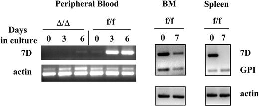 Figure 7. VCAM-1 is expressed in proliferating myeloid cells in vitro from BM or PB, but not in proliferating lymphoid cells. Mononuclear cells from the bone marrow or peripheral blood, or cells isolated from the spleen of VCAM-1f/f or VCAM-1Δ/Δ mice were cultured for up to 7 days as described in “Materials and methods.” Total RNA was isolated and reverse transcribed using oligo-dT primer. PCR was performed using long VCAM-1 isoform-specific primers (7D), GPI-linked VCAM-1 isoform-specific primers (GPI), and actin-specific primers as internal controls. Note that cultured PB cells express VCAM-1 mRNA only after 3 to 6 days in culture with cytokines, but not before, whereas BM cells express VCAM-1 both before and after culture (BMf/f day 0 and day 7). Of interest, cells from the spleen show expression of the 7 domain (full-length) form of VCAM-1 before culture, likely attributed to myeloid cells in spleen, but not after culture under lymphoid conditions. Lymphoid cells proliferating under the stimulus of IL-7 and IL-2 display only the GPI-anchored form.