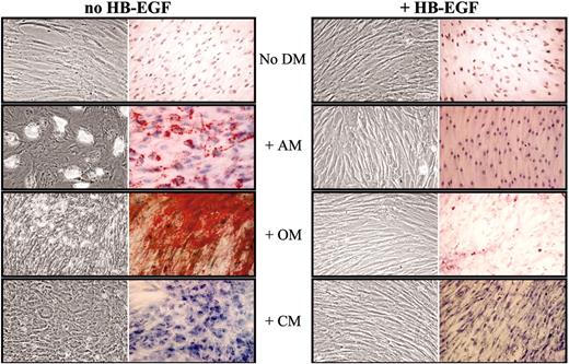 Figure 6. HB-EGF prevents MSC differentiation induced by specific media. Confluent MSCs were cultured for 14 days in flasks and culture slides with no differentiation medium (No DM) or in the presence of adipogenic (AM), osteogenic (OM), or chondrogenic (CM) medium, without and with 50 ng/mL HB-EGF; then cells were stained with Oil-red-O, von Kossa, and toluidine blue methods, respectively, to assess MSC differentiation. MSCs cultured in the presence of HB-EGF did not show any specific differentiation. The figure shows a representative case of 3 different experiments. In each box, left images show unstained cells and right images show cells stained with specific dyes. Images were visualized through an Olympus BX50 microscopic equipped with UPlan FL 100×/1.30 oil objective lens (Olympus, Tokyo, Japan). Acquisition was performed with Nikon ACT-1 2.20 software (Nikon, Tokyo, Japan); processing, with Adobe Photoshop 7.0 (Adobe, San Jose, CA).