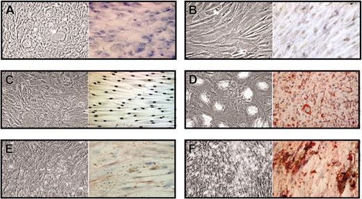 Figure 8. HB-EGF preserves multilineage stem cell potential. MSCs were cultured for one week in the presence of CM without and with 50 ng/mL HB-EGF, which was added 2 hours before CM and left for the entire culture. Then both groups were cultured for 2 weeks with AM or OM, without HB-EGF and CM. MSCs treated with CM without HB-EGF underwent differentiation into chondrocytes, as suggested by morphology and Toluidine blue (A), while MSCs cultured with HB-EGF and CM did not (B). Adipogenic and osteogenic differentiation were not achieved with untreated MSCs (C,E), but only with HB-EGF–pretreated MSCs (D,F). The presence of HB-EGF in the preliminary culture with CM not only prevented MSC differentiation into chondrocytes, but also preserved their multilineage stem cell potential. The figure shows a representative case of 3 different experiments. Image visualization, acquisition, and processing were performed as for Figure 6.