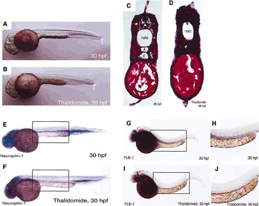 Figure 1. Thalidomide induced vascular defect during the development of zebrafish embryos. Zebrafish embryos were treated at 75% epiboly stage (8 hpf) without (A,C,E,G) or with 800 μM thalidomide (B,D,F,I) and examined at the indicated hpf stages. (A-D) Lateral view of fixed embryo shows that thalidomide-treated embryos (B) are shorter in length than the control (A), as indicated by white arrows. Hematoxylin and eosin staining for the transverse section of thalidomide-treated embryos shows that the lumens of the dorsal artery (marked “A” in panel C) and posterior cardinal vein (marked “V” in panel C), which are evident in the control embryo (C), are lost in the thalidomide-treated embryo (D). (E-J) In situ mRNA hybridization is performed for endothelial markers neuropilin-1 (E,F) and FLK-1 (G-J). Expressions of neuropilin-1 and FLK-1 are absent at the region corresponding to dorsal artery and vein (indicated by boxes) after treatment with thalidomide (F,I). The defect of FLK-1 expression at large vessels is more evident by a higher magnification (H,J). The results are representative of each experiment. noto indicates notochord; A, dorsal artery; V, posterior cardinal vein; hpf, hours after fertilization. Original magnification of panels A, B, E, F, G, and I is ×40; of C and D, ×150; and of H and J, ×63. The images were visualized using an Olympus BH2 Biological microscope equipped with an SPlan APo20 20×/0.70 objective lens and a C-35AD-2 camera (Olympus, Tokyo, Japan) or a Nikon Stereoscope SMZ1000 microscope equipped with a Plan Apo 1×/0.10 objective lens with zoom system covering the total magnification to 40× and 60×, and an FDX-35 camera (Nikon, Tokyo, Japan). Images were processed with Adobe Photoshop 7.0 software (Adobe Systems, San Jose, CA).
