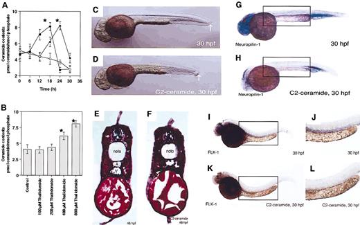 Figure 2. Thalidomide increases endogenous ceramide during the development of zebrafish embryos, and exogenous C2-ceramide mimics thalidomide-induced antiangiogenic action. (A,B) Zebrafish embryos were treated at 75% epiboly stage (8 hpf) with the indicated concentrations of thalidomide, and harvested at various times (A) or 18 hours after treatment (B). Lipids were extracted, and ceramide content was measured by the DGK assay as described in “Materials and methods.” (A) ○ indicates control; ♦, 400 μM thalidomide; and •, 800 μM thalidomide. The results were obtained from 3 independent experiments. The error bars indicate 1 SD. *The difference in ceramide content between the embryos treated with thalidomide and the control embryo is statistically significant at P < .01 by ANOVA test. (C-F) Lateral view of fixed embryo shows that 10 μM C2-ceramide–treated embryos (D) are shorter in length than the control (C), as indicated by white arrows. Hematoxylin and eosin staining for the transverse section of C2-ceramide–treated embryos shows that the lumens of the dorsal artery (marked “A” in panel E) and posterior cardinal vein (marked “V” in panel E), which are evident in the control embryo (E), are lost in the C2-ceramide–treated embryo (F). (G-L) Expressions of neuropilin-1 and FLK-1 mRNA at the region corresponding to dorsal artery and vein are not detected after treatment with C2-ceramide as well as thalidomide (indicated by boxes; H,K). The defect of FLK-1 expression is more evident by the higher magnification (J,L). The results are representative of each experiment. noto indicates notochord; A, dorsal artery; V, posterior cardinal vein; hpf, hours after fertilization. Original magnifications of panels are as follows: C, D, G, I, H, and K, ×40; E and F, ×150; and J and L, ×63. Image acquisition was performed as described for Figure 1.