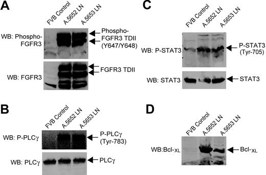 Figure 7. Activation of PLCγ and STAT3 in tumors of EμSR-FGFR3 TDII transgenic mice. Spleen samples from a healthy normal FVB mouse were included as a control. (A) FGFR3 TDII is expressed and constitutively activated in the tumor tissues of EμSR-FGFR3 TDII transgenic mice A.5652 and A.5653. Expression of FGFR3 TDII was detected by immunoblotting in lymph node cell lysates. The activating tyrosine-phosphorylated FGFR3 TDII was detected by an antibody specifically recognizing the 2 phosphorylated activation loop tyrosine residues in FGFRs. (B) PLCγ is hyperphosphorylated and activated in the tumor tissues by FGFR3 TDII in transgenic mice. (C-D) Elevated tyrosine phosphorylation of STAT3 and expression of Bcl-XL in tumor tissues of FGFR3 TDII transgenic mice.