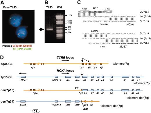 Figure 1. A new chromosomal translocation involves the TCRB and HOXA loci. (A) A TCRB chromosomal translocation was identified in leukemic cells of patient TL43 by dissociation of TCRB-flanking FISH probes. The centromeric Vβ-flanking probe (CTD-3092H9) and the telomeric Cβ-flanking probe (RP11-168I15) were labeled with Texas red and fluorescein isothiocyanate (FITC), respectively. Original magnification, × 63. (B) A 541-bp fragment containing the Dβ1 breakpoint was produced by circled nested PCR (left lane, the rearranged band is shown by an arrow; right lane, molecular weight marker). (C) Breakpoint and flanking sequences of both derivative chromosomes of the TCRB-HOXA translocation TL43. Recognition sequence signal (RSS) heptamer and putative heptamer-like sequence are indicated according to consensus.27 Untemplated nucleotides (N-diversity) are typed in lowercase. GL indicates germline; der, derivative chromosomes. (D) Schematic representation of the TCRB-HOXA translocation TL43, drawn to scale according to data from the IMGT Information System (http://imgt.cines.fr) and the UCSC Genome Bioinformatics site (http://genome.ucsc.edu/), and to the DNA sequences of the breakpoint regions of the 2 derivative chromosomes. Chromosomes are depicted according to the direction of the TCRB and HOXA gene transcription (except for the EVX1 gene, which is transcribed in the opposite direction as indicated by arrow). Breakpoints are indicated with arrows.