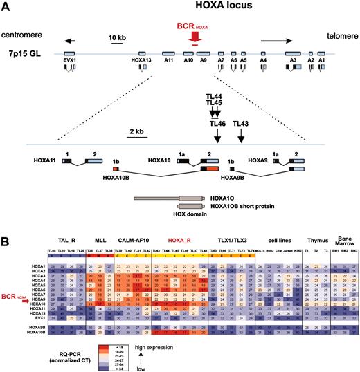 Figure 3. Clustering of the breakpoints and dysregulated expression of the HOXA genes in leukemias with TCRB-HOXA rearrangement. (A) The 4 breakpoints cluster in a 2.6-kb breakpoint cluster region (BCRHOXA) as indicated. The direction of transcription is shown by arrows (centromere to telomere for the HOXA genes, and opposite direction for EVX1). Transcription products of the HOXA genes are drawn according to the data of the UCSC site. The HOXA10B exons are shown as red boxes. The rearrangements disrupt the HOXA locus at the 3′ end of HOXA10 gene (cases TL44, TL45, and TL46), and within the intron Ib region of HOXA9 (TL43), as indicated. Open reading frames are shown as black boxes. The 2 isoforms of the HOXA10 protein (HOXA10A, quoted HOXA10, and HOXA10B) are drawn according to previous reports, and the homeobox DNA-binding domain is indicated.32-34 (B) Analysis of expression of the HOXA genes by specific real-time RT-PCR in T-ALL samples. The HOXA and EVX1 expression values are shown in the 4 HOXA-rearranged cases (marked t), and the 2 HOXA-related cases without detected chromosomal rearrangement (TL47 and TL48, marked *), which constitute the HOXA_R group. Values in the 3 MLL-rearranged cases, the 4 CALM-AF10 cases, a panel of TAL_R and TLX1/TLX3 samples, T-cell lines, normal human thymus, and normal bone marrow samples are shown. HOXA9B and HOXA10B transcripts were also analyzed (bottom rows). Median normalized Ct values are indicated and a color scale was used as shown.