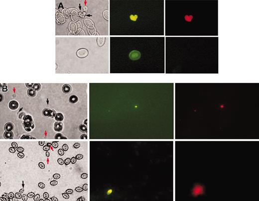 Figure 2. Young zebrafish thrombocytes. (A) Demonstration of newly synthesized young thrombocytes. Top row shows images of zebrafish thrombocytes (young and mature thrombocytes are marked by black and red arrows, respectively); bottom row, red cells. From left to right are the images under bright field, fluorescence with excitation at 450 nm to 490 nm (BrdU uptake shown by anti-BrdU FITC green fluorescence), and fluorescence with excitation at 510 nm to 560 nm (DiI red fluorescence) using a Nikon Optiphot phase-contrast fluorescence microscope. (B) Comparison of young thrombocytes with young human platelets. Top row shows images of human platelets; bottom row, images of zebrafish thrombocytes. Images from left to right are under bright field, fluorescence with excitation at 450 nm to 490 nm (TO fluorescence) and fluorescence with excitation at 510 nm to 560 nm (DiI fluorescence) using a Nikon Optiphot phase-contrast fluorescence microscope. Black arrows show young thrombocytes and young human platelets and red arrows show mature thrombocytes and mature human platelets. The other cells in the field are zebrafish erythrocytes (bottom row) or human red cells (top row).